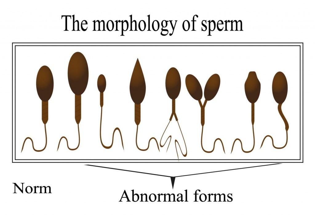 مورفولوژی (شکل) طبیعی اسپرم